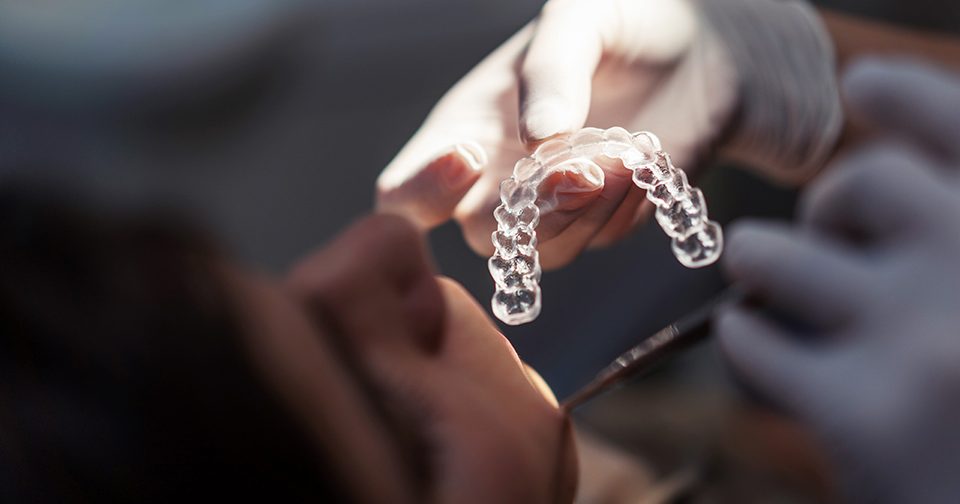 Orthodontie adulte Chirurgien-dentiste Strasbourg Dr Viviane Sendroiu