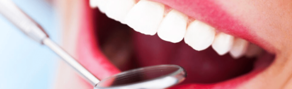 ésthétique dentaire Chirurgien-dentiste Dr Viviane Sendroiu Strasbourg